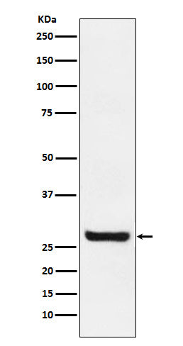 Western blot analysis of Sprouty 4 expression in MCF7 cell lysate.