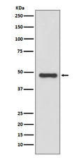 Anti-Urokinase Rabbit Monoclonal Antibody