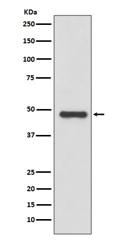 Anti-Urokinase Rabbit Monoclonal Antibody