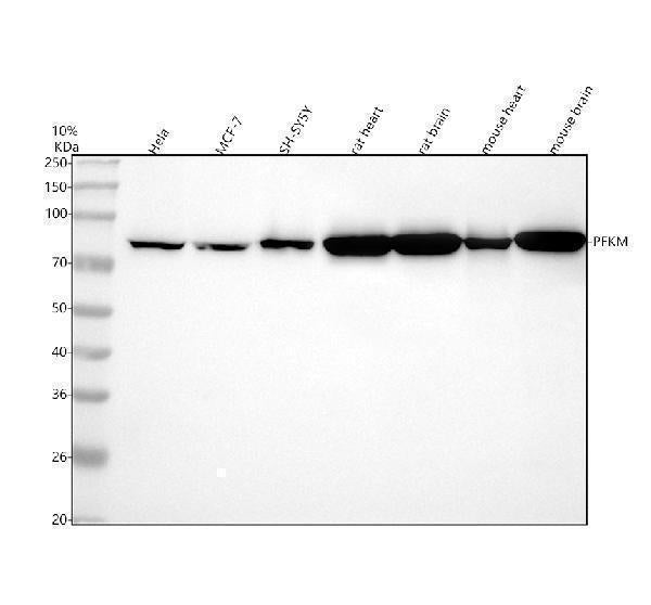 Anti-Fructose 6 Phosphate Kinase Rabbit Monoclonal Antibody