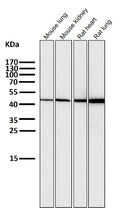 All lanes use the Antibody at 1:1K dilution for 1 hour at room temperature.