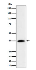 Western blot analysis of RASSF2 expression in Jurkat cell lysate.