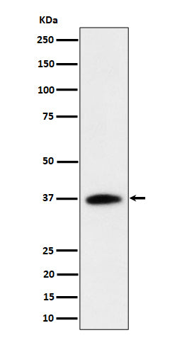 Western blot analysis of RASSF2 expression in Jurkat cell lysate.