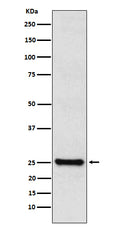 Western blot analysis of TPPP expression in SHSY5Y cell lysate.