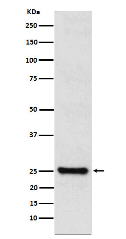 Western blot analysis of TPPP expression in SHSY5Y cell lysate.
