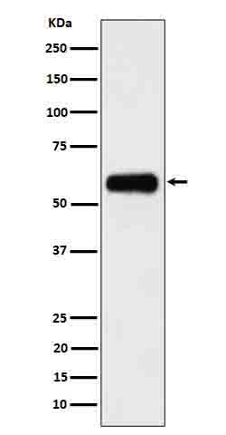 Western blot analysis of CD116 in 293 cell lysate.