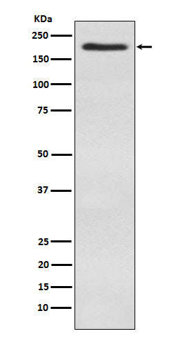 Western blot analysis of WSTF expression in SH-SY5Y cell lysate.