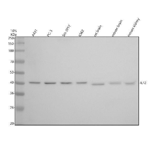 Anti-ILF2 Rabbit Monoclonal Antibody