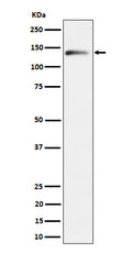 Western blot analysis of delta 2 Catenin expression in Mouse brain cell lysate.