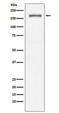 Western blot analysis of CD11a expression in Jurkat cell lysate.