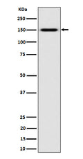 Western blot analysis of SLC12A1 / NKCC2 expression in K562 cell lysate.