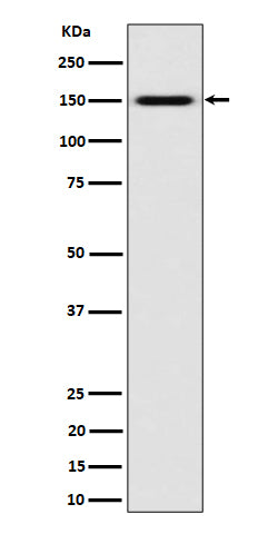 Western blot analysis of SLC12A1 / NKCC2 expression in K562 cell lysate.