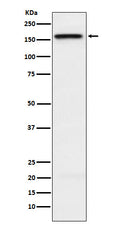 Western blot analysis of KIF4A expression in HeLa cell lysate.