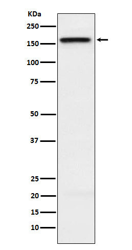 Western blot analysis of KIF4A expression in HeLa cell lysate.
