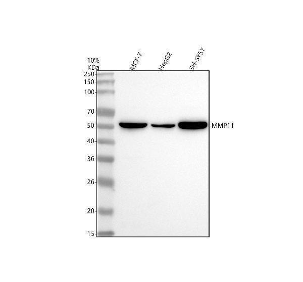 Anti-MMP11 Rabbit Monoclonal Antibody