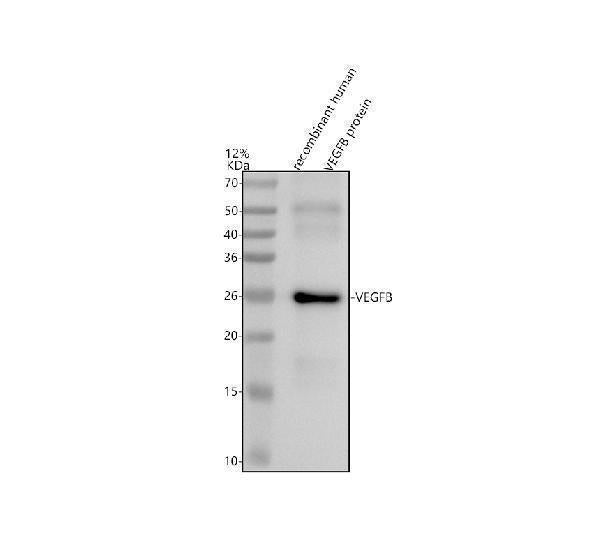 Anti-VEGFB Rabbit Monoclonal Antibody