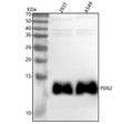 Anti-PEN2 Rabbit Monoclonal Antibody
