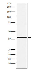 Western blot analysis of CAPG expression in HeLa cell lysate.