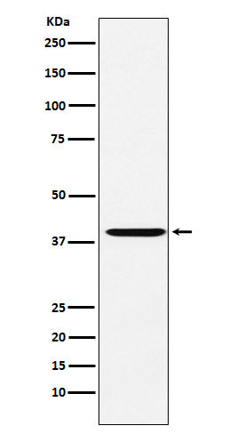 Western blot analysis of CAPG expression in HeLa cell lysate.