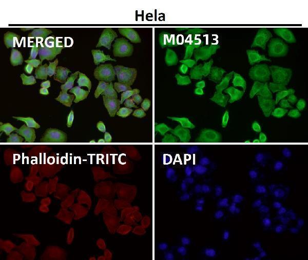 Immunofluorescent analysis using the Antibody at 1:50 dilution.