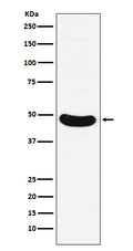 Western blot analysis of HB9/HLXB9 expression in Molt-4 cell lysate.