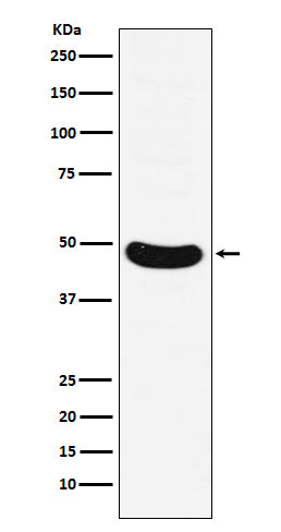 Western blot analysis of HB9/HLXB9 expression in Molt-4 cell lysate.