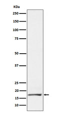 Western blot analysis of GCDFP 15 expression in T47D cell lysate.