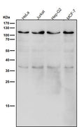 All lanes use the Antibody at 1:1K dilution for 1 hour at room temperature.