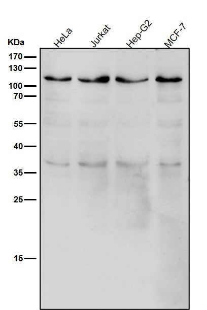 All lanes use the Antibody at 1:1K dilution for 1 hour at room temperature.