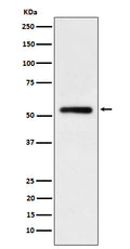 Western blot analysis of human IgG1 expression in Human tonsil cell lysate.