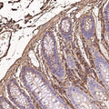 Immunohistochemical analysis of paraffin-embedded Human colon, using the Antibody at 1:100 dilution.