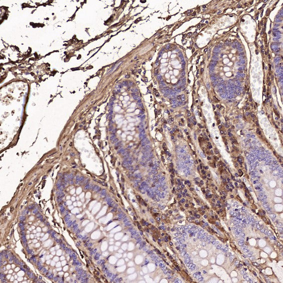 Immunohistochemical analysis of paraffin-embedded Human colon, using the Antibody at 1:100 dilution.