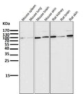 All lanes use the Antibody at 1:5K dilution for 1 hour at room temperature.