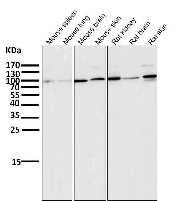 All lanes use the Antibody at 1:5K dilution for 1 hour at room temperature.