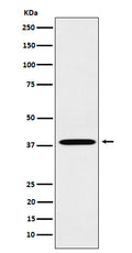 Western blot analysis of LTB4R expression in A549 cell lysate.
