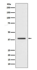 Western blot analysis of macroH2A.1 expression in HepG2 cell lysate.