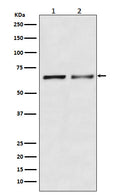 Western blot analysis of Activin Receptor Type IIB/ACVR2B expression in (1) K562 cell lysate; (2) Mouse heart lysate.