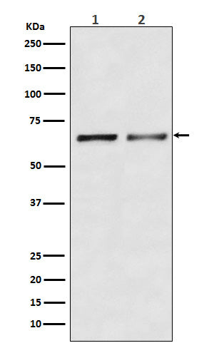 Western blot analysis of Activin Receptor Type IIB/ACVR2B expression in (1) K562 cell lysate; (2) Mouse heart lysate.