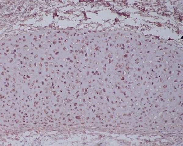 Immunohistochemical analysis of paraffin-embedded human cartilage tissue, using Aggrecan Antibody.
