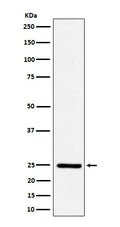 Western blot analysis of Ephrin A1 expression in HUVEC cell treated with TNF alpha.