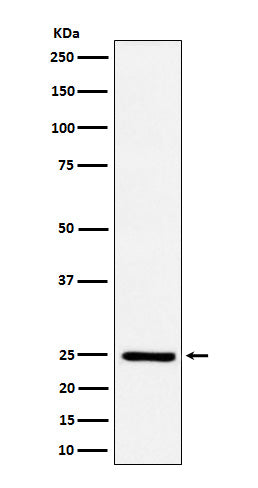 Western blot analysis of Ephrin A1 expression in HUVEC cell treated with TNF alpha.