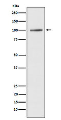 Western blot analysis of ATP2A1/SERCA1 expression in human fetal muscle lysate.