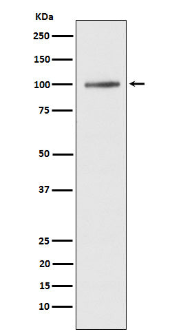 Western blot analysis of ATP2A1/SERCA1 expression in human fetal muscle lysate.
