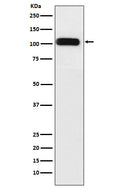 Western blot analysis of SERCA1 ATPase expression in Human fetal muscle lysate.
