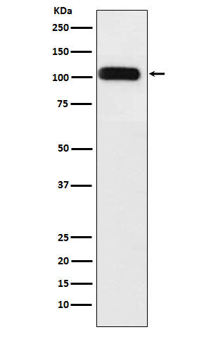 Western blot analysis of SERCA1 ATPase expression in Human fetal muscle lysate.