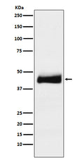 Western blot analysis of ORM1 expression in human testis lysate.