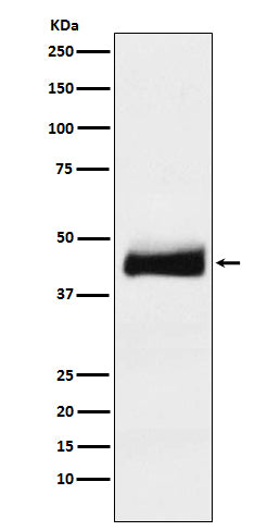 Western blot analysis of ORM1 expression in human testis lysate.