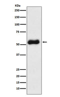 Western blot analysis of Thromboxane synthase expression in Human fetal liver lysate.