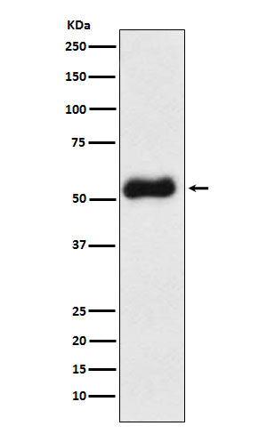 Western blot analysis of Thromboxane synthase expression in Human fetal liver lysate.
