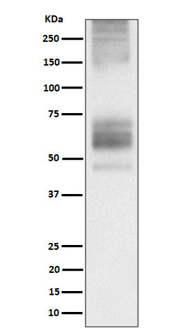 Western blot analysis of Somatostatin Receptor 1 expression in 293T transfected with Somatostatin Receptor 1 cell lysate.